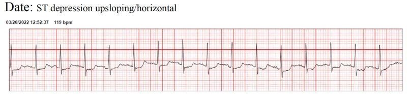 NimbleHeart