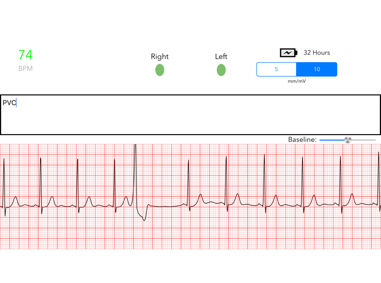 NimbleHeart